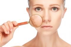ニキビ跡が色素沈着してシミになる!?おすすめのスキンケアや予防法を紹介