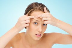 ニキビが出来たら皮膚科へ行こう!病院ではどんな治療が受けられる?