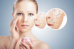乾燥肌はニキビができやすい?乾燥ニキビの原因やおすすめの保湿化粧品を紹介