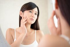 しこりのようなニキビ跡が治らない!原因から皮膚科での治療法まで徹底解説