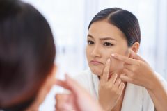 なかなか治らない黒ニキビの原因と対策を紹介!潰して芯を出すのはNG!?