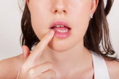 唇や口周りにできるニキビの原因と対処法!ヘルペスとの違いはある?