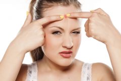 おでこニキビの原因と対処法!思春期にできやすく大人はできにくい?