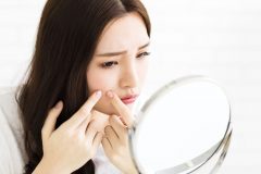 頬にできるニキビは乾燥が原因!?繰り返しできやすい頬ニキビのケア方法