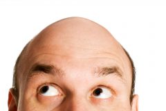 なんで髪の毛が薄くなっちゃうの…?!知りたい!薄毛の対策方法