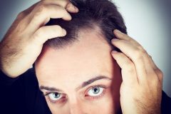 皮膚が赤い・かさぶたが白?あなたの頭皮のかゆみ、見逃さないで