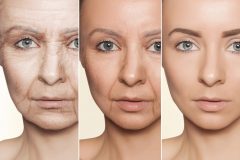 アンチエイジングとエイジングケアの違いって何?肌の老化の原因と対策