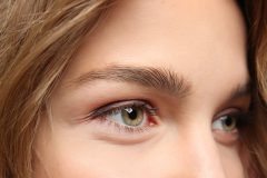 年齢がバレるパーツ第一位?美しく歳を重ねる為に!ケアの難しい目尻のシワ対策