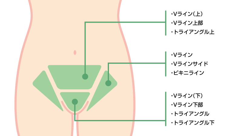 Vライン脱毛におすすめのサロン クリニックを紹介