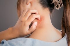 アトピー肌にスキンケアは必要?子供も大人も使える化粧水の選び方